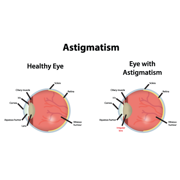 Eye Exam